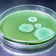 Mold growing in a petri dish on a stainless steal table in a laboratory.